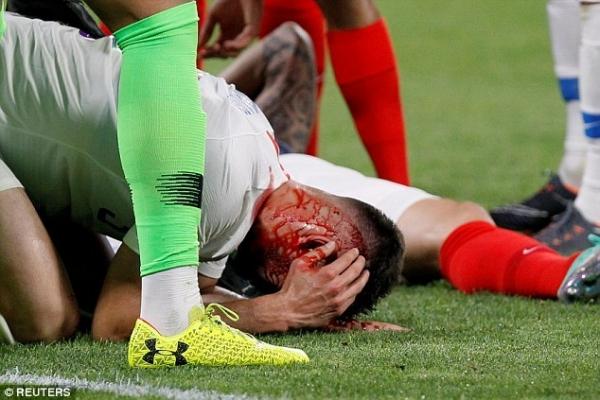 葡萄牙中卫佩雷拉训练时受伤